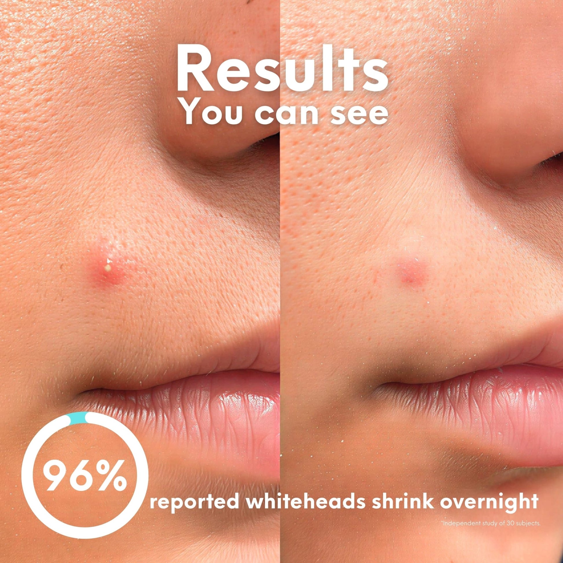 Breakout Classic Duo - Skin Choice